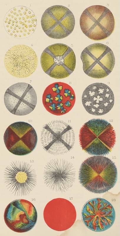 Oleomargarina (figs. 11 y 12) y otros cristales de grasa, del método para identificar la adulteración de las grasas del microscopista Thomas Taylor, 1886. Imagen Science History Institute.